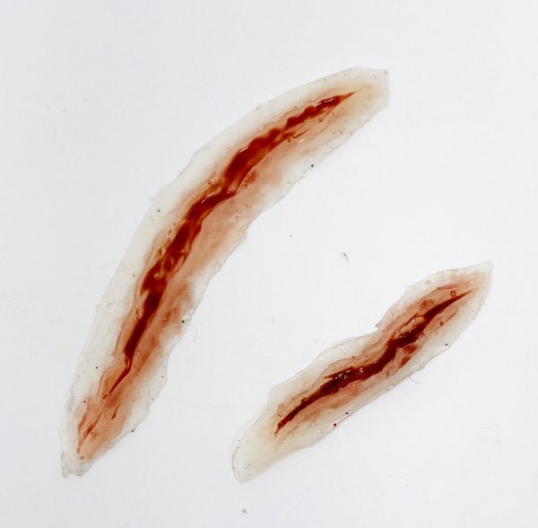 Wound Kit