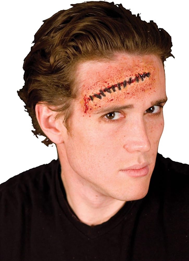 Stitches Wound Appliance